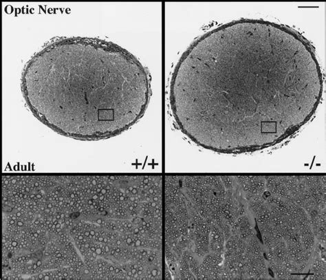 Semithin Sections Of Myelinated Axons In The Optic Nerve Of Adult