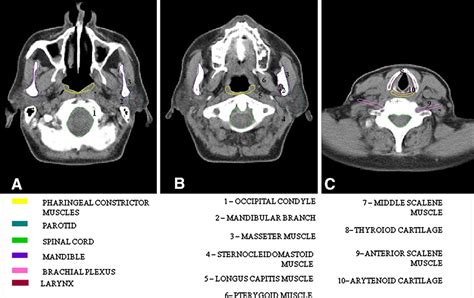 Delineating Brachial Plexus Cochlea Pharyngeal Constrictor Muscles