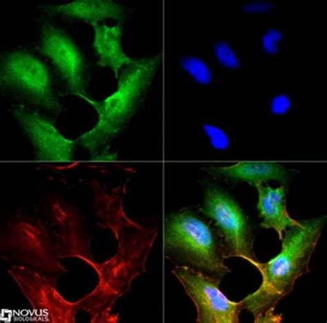 Sr Bi Antibodyantibodiesprimary Antibodies Fisher Scientific