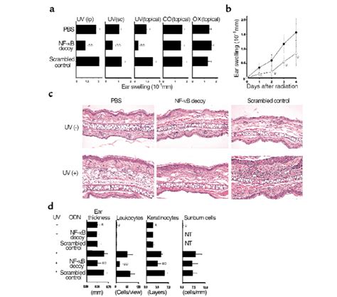 Impact of topically applied NF κB decoy ODN on UV induced inflammation