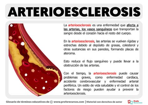 Qué es la Arterioesclerosis