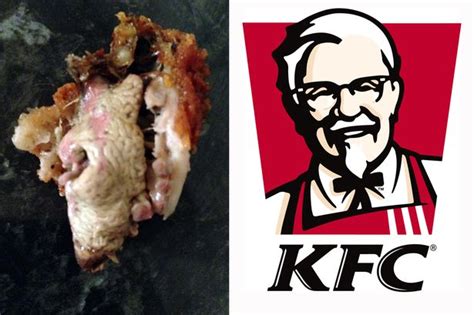 Nurses Disgust As She Finds Gruesome Body Part In Kentucky Fried