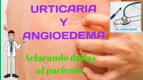 ALERGIAS URTICARIA Y ANGIOEDEMA PARA EL PACIENTE YouTube