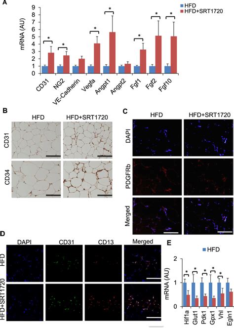 Srt Treatment Enhances Vasculature In Ewat A Mrna Expression Of