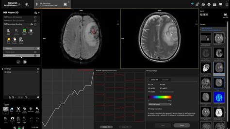 Syngo Via Siemens Healthineers India