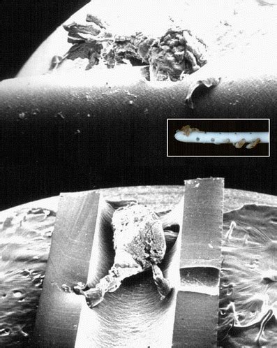 Electron microscopy and photographic images of an occluded catheter ... 