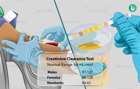 Creatinine Clearance Test Kantipur Path Lab