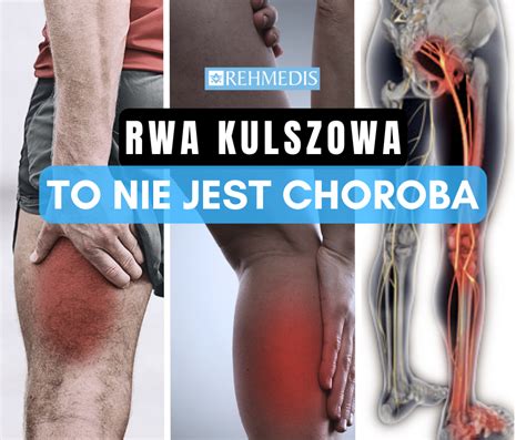 Rwa Kulszowa To Nie Choroba Rehmedis Pl