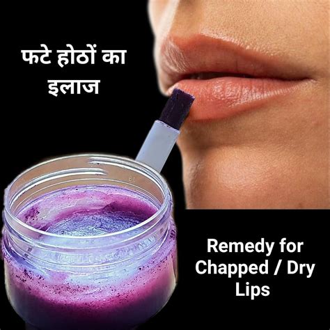 Remedy for Chapped / Dry Lips | Dry lips, Remedies, Lips