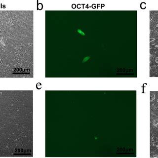 OCT4 MES And TG IPS 1 7 Are Pluripotent A And B Phase Contrast