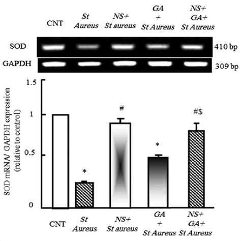 Semiquantitative Reverse Transcription Polymerase Chain Reaction