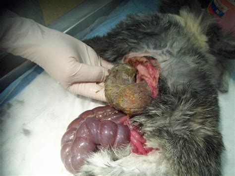 Gigantic Hairball Trichobezoar Still In Stomach This Rab Flickr