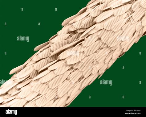 Scanning electron Microscope image of Mosquito proboscis magnified approximately 390X (color ...