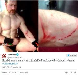 Sheamus Suffers Injury During Backstage Segment On Raw Stillrealtous