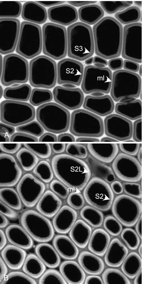 Figure From Exploring The Ultrastructural Localization And