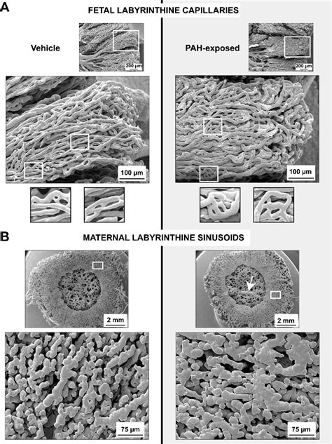 Figure From Fetal Growth Restriction Triggered By Polycyclic Aromatic