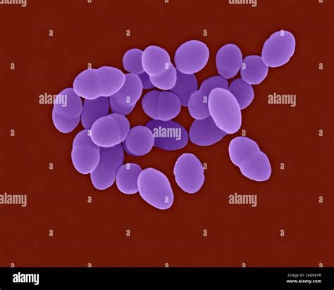 Farbige Scanning Electron Micrograph Sem Von Streptococcus Pneumoniae