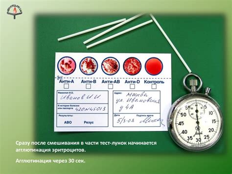 Экспресс-тестирование групп крови человека - презентация онлайн