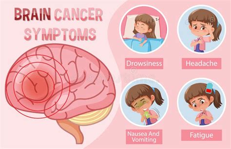 Medical Information On Brain Cancer Symptoms Stock Vector