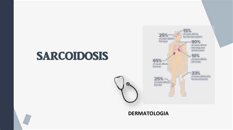 Sarcoidosis Karla Serrano Mej A Udocz