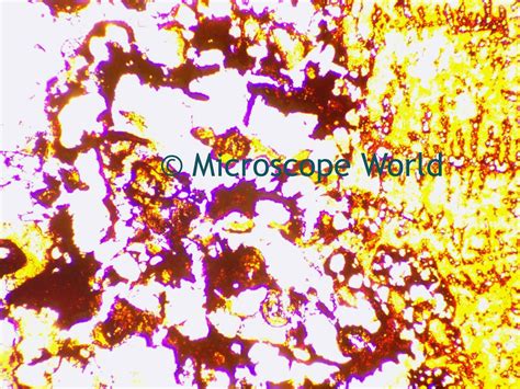 Microscope World Blog: Tuberculosis under the Microscope