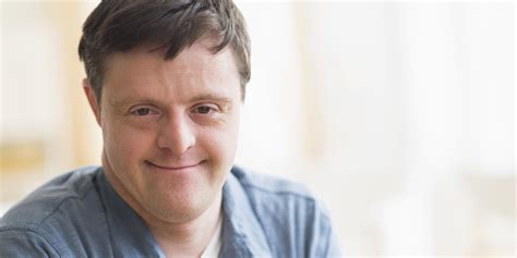 Люди С Синдромом Фото – Telegraph