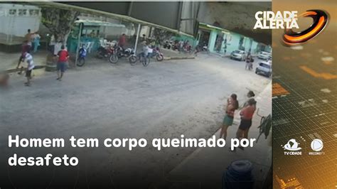 Homem Tem Corpo Queimado Por Desafeto Motivo Seria Por Morte De