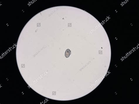 Otodectes Cynotis Egg Describes As Ear Mites Under The Microscope This Mites Are Found In Cat