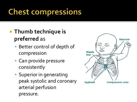 Neonatal resuscitation programme, NRP