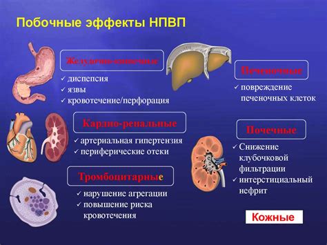 Нестероидные противовоспалительные препараты (НПВП) - презентация онлайн