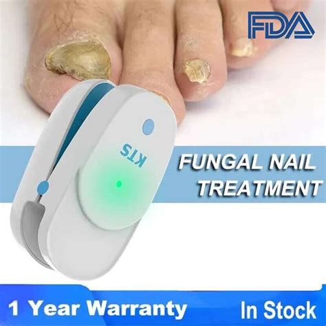 Fungal Nail Treatment Laser Device - Howie Has It