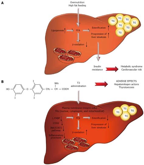 Thyroid Hormone Analogues And Derivatives Actions In Fatty Liver