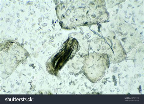 Skin Under Microscope Background Stock Photo 127675190 | Shutterstock