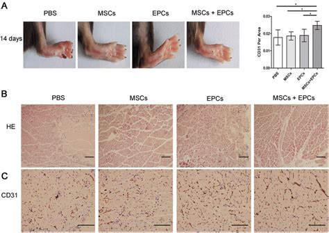 Morphologic Observation And Histological Analysis Of Mice Ischemic Hind