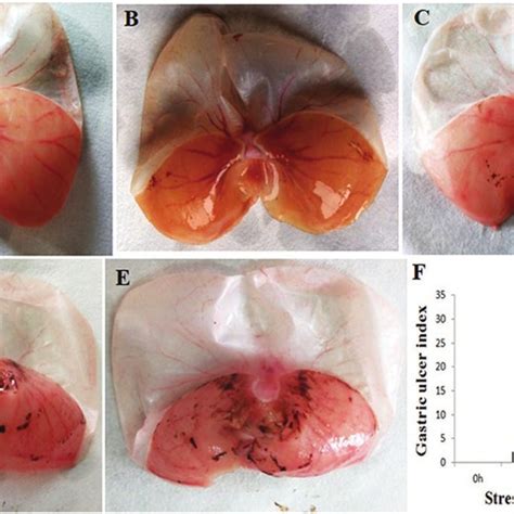 Effects Of Restraint Water Immersion Stress Rwis On Gastric Mucosal