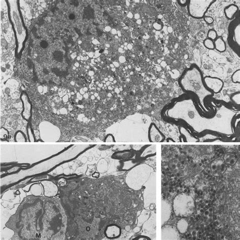 Balb C Mouse Spinal Cord Dpi Naked Axons Macrophages And Myelin