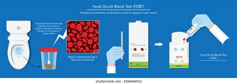 Faecal Occult Blood Test How Faecal Occult Blood Test Reveals High