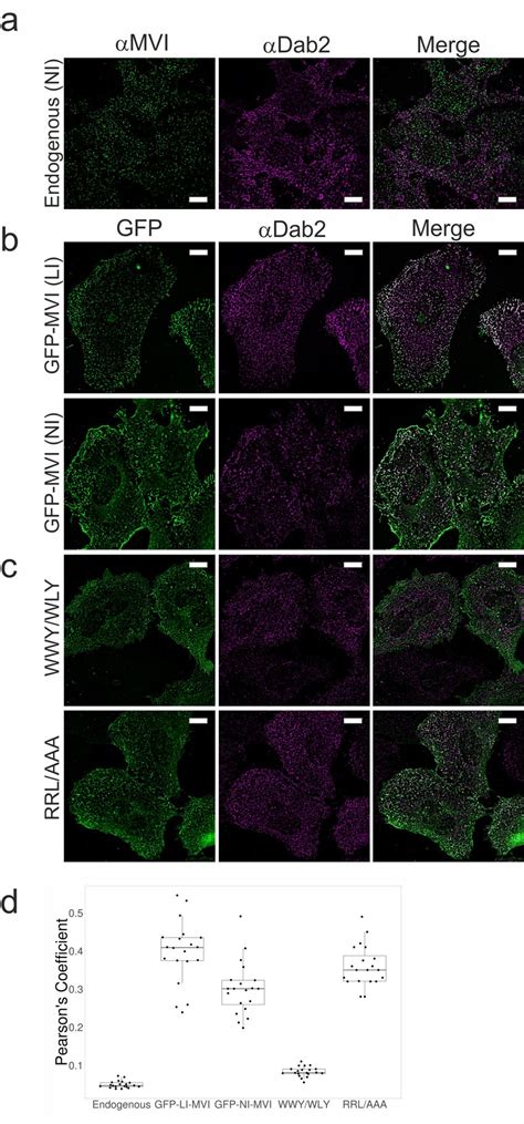 Myosin VI Interaction With Dab2 In HeLa Cells A Immunofluorescence