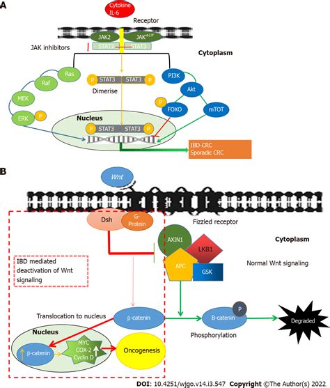 Inflammatory Bowel Disease Related Colorectal Cancer Past Present And