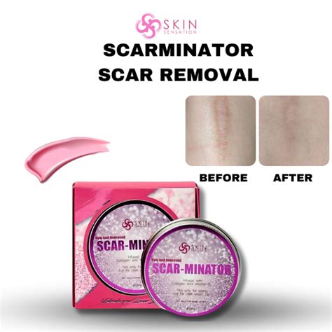 Scarminator Cream Original 100 Effective Scar Remover Skin Whitening