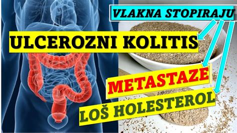 P Eni Ne Mekinje Vlakna Stopiraju Ulcerozni Kolitis Lo Holesterol I