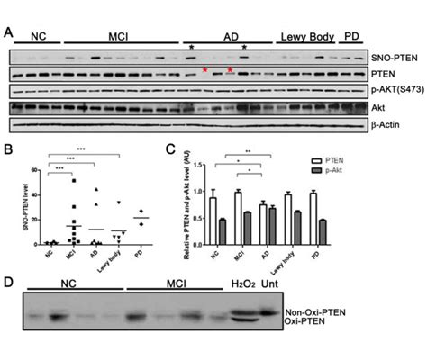 Quantitative Analysis Of Pten And P Akt Levels In Relation To Sno Pten