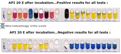 Biochemical Test Archives Microbiology Info