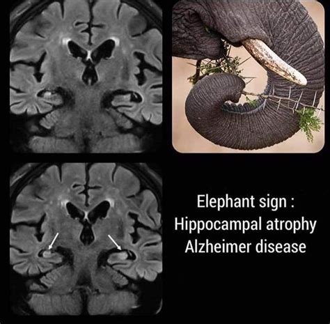 Pin by Aleksandra Stawik on Medyczne | Radiology, Diagnostic medical sonography, Neurology