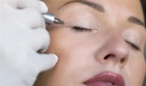 Eyeliner Tattoo Removal Types And How Does They Works