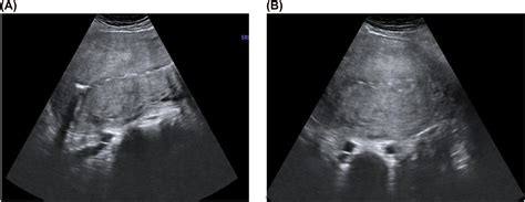 Ultrasound In Labor Clinical Practice Guideline And Recommendation By