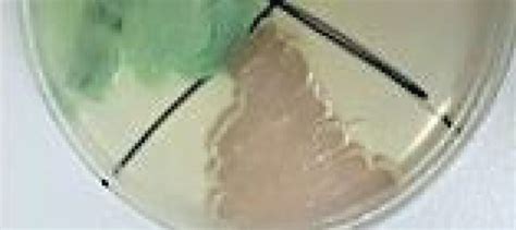 Appearance Of Yeast Colonies On Chrom Agar Candida A Candida