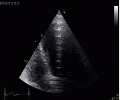 Ultrasound Physics Chapter 21 Artifacts Flashcards Quizlet