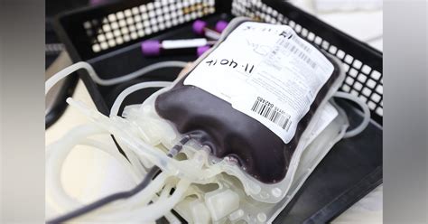 AABB session explores blood-donation deferral policies | Medical Laboratory Observer