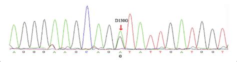 Sanger sequencing electropherogram. The variant (c.389A > G ...